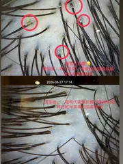 頭皮spa作品，設計師 Evon，台北大同區He&She Hair Salon