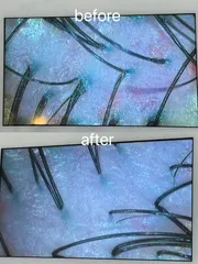植萃頭皮調理作品，設計師 U咪，台南歸仁區尼曼造型