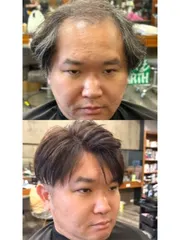 男士微型增髮作品，設計師 羅東髮型師Ruby，宜蘭羅東鎮髮朵髮廊