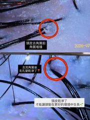 頭皮護理作品，設計師 𝑱𝒆𝒔𝒔𝒊𝒆潔西🫶🏻，台北大安區Epoch salon