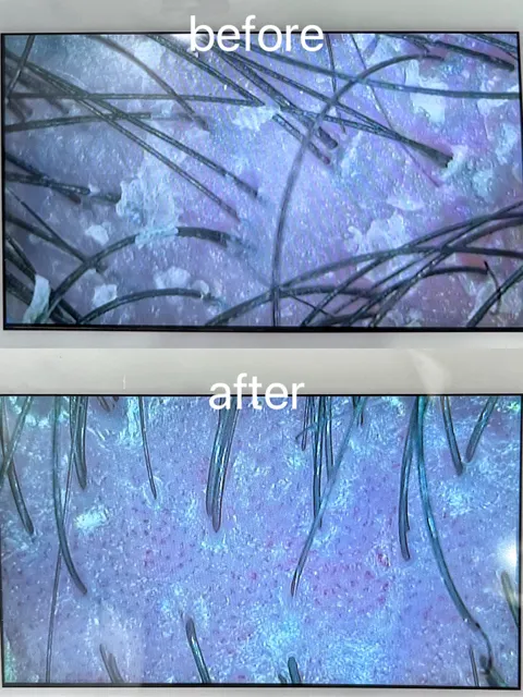 植萃頭皮調理作品參考，設計師 U咪