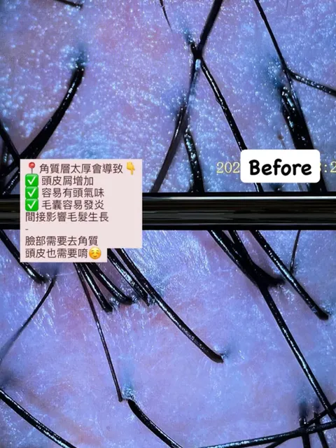 頭皮護理作品參考，設計師 𝑱𝒆𝒔𝒔𝒊𝒆潔西🫶🏻